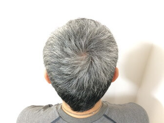白髪染めする前の頭